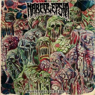 NARCOLEPSIA - Anomalia Cerebral